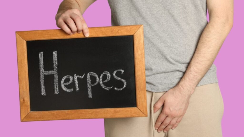 Genital Herpes Treatment