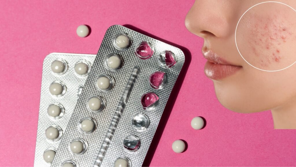 birth control and acne