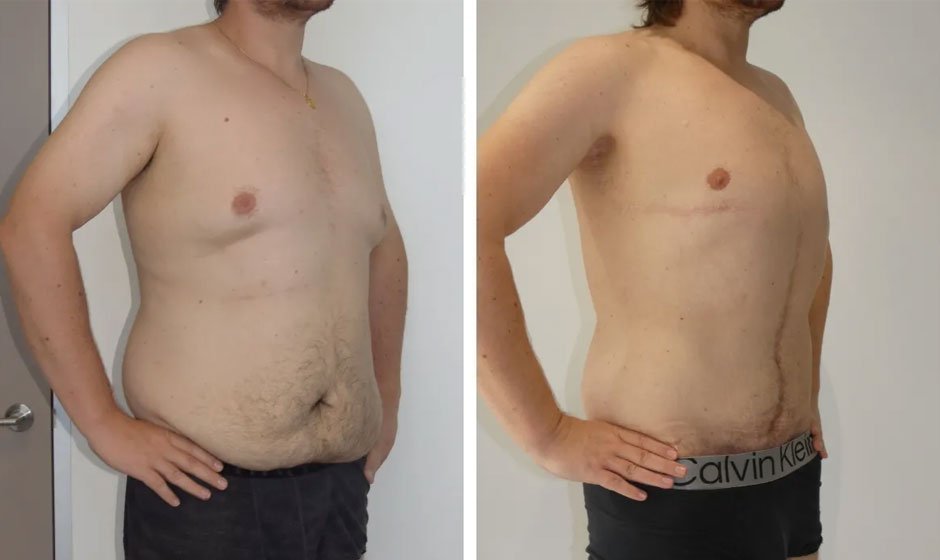 weight-loss-2