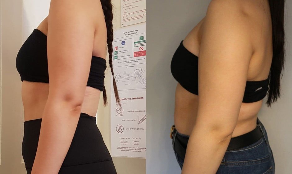 weight-loss-5