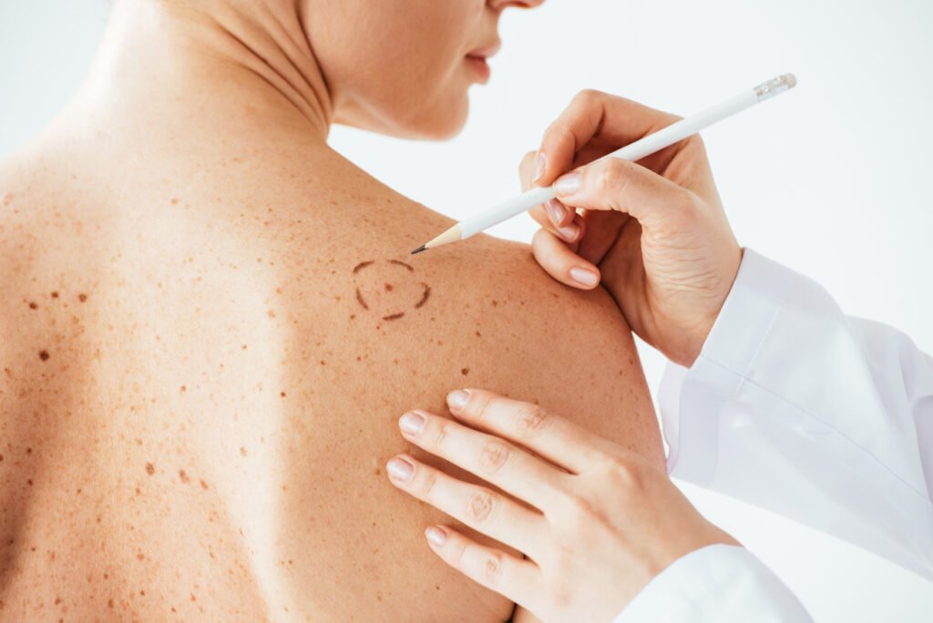 dermatology skin care