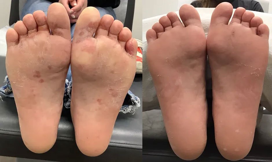 footr-before-after-3